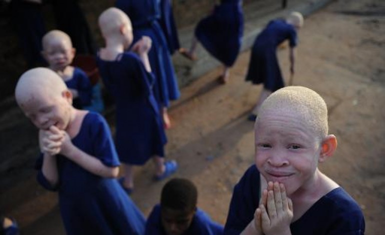 Dar es Salaam (AFP). Albinos en Tanzanie: une vie de stigmatisation et de violence