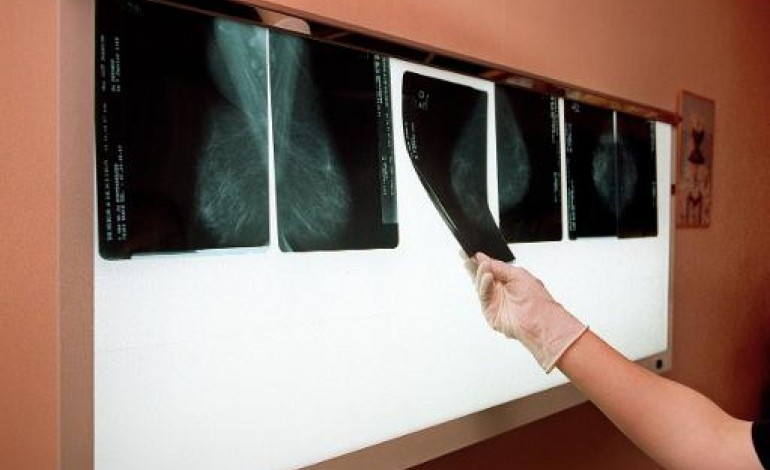 Chicago (AFP). Une nouvelle thérapie ciblée confirme son efficacité contre le cancer du sein 