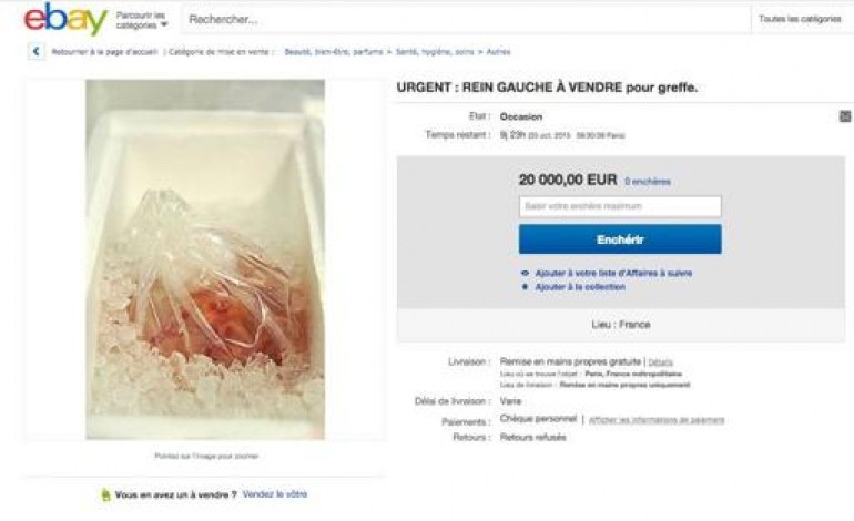 Un rein humain à vendre sur Ebay - 20 000 euros.