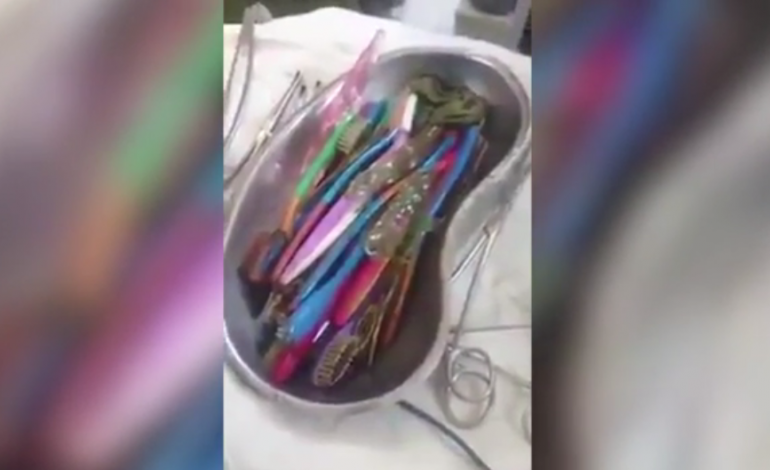 Des chirurgiens retirent 18 brosses à dents de l'estomac d'un patient