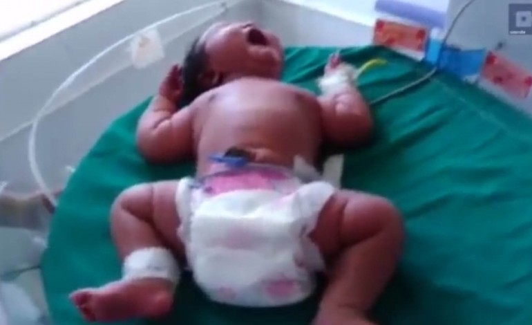 Record : une Indienne donne naissance à une fille de 6,8kg