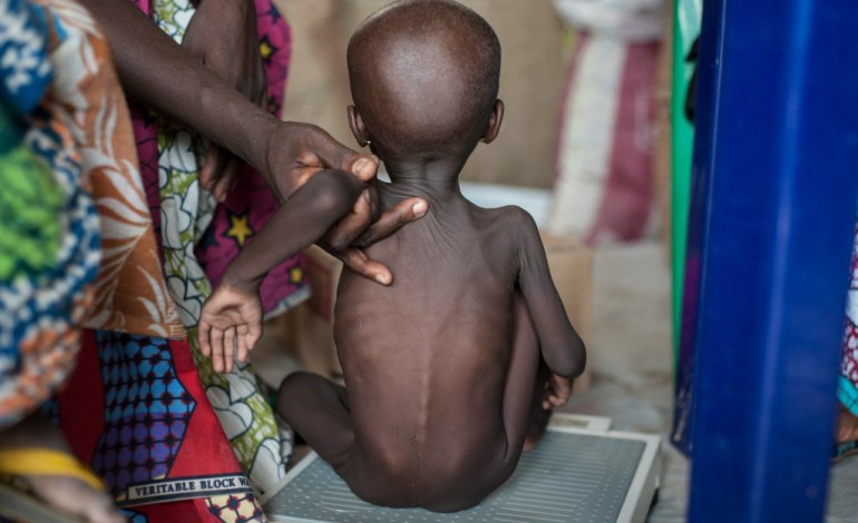 Paris (AFP). Syrie, Yémen, Nigeria: agriculture décimée, la faim comme  arme de guerre