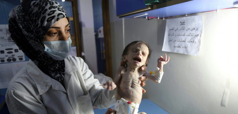 Syrie: dans la Ghouta assiégée, la mort rôde autour d'enfants malnutris
