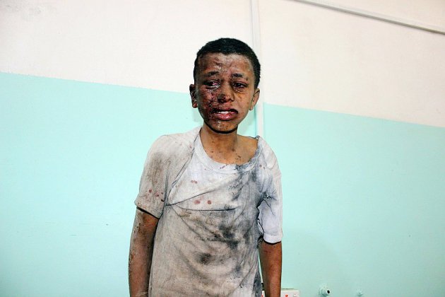 Yémen: au moins 29 enfants tués dans une attaque contre un bus