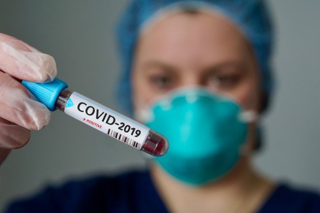 Coronavirus : vos questions, nos réponses. Pourquoi parle-t-on de Covid-19 ?