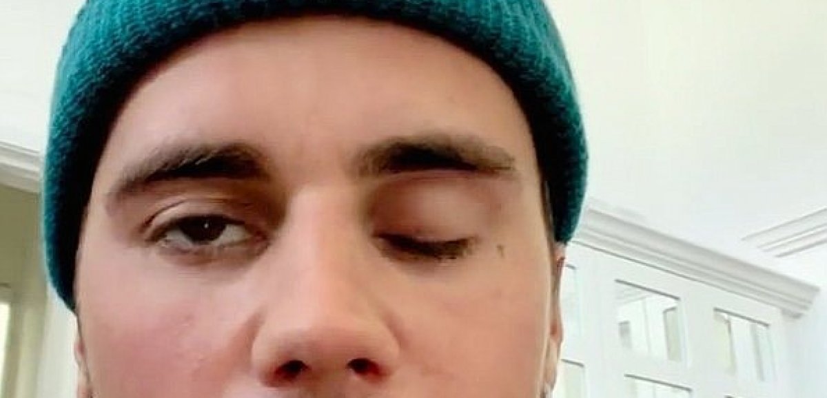 Musique. Justin Bieber guéri de sa paralysie faciale de retour prochainement sur scène