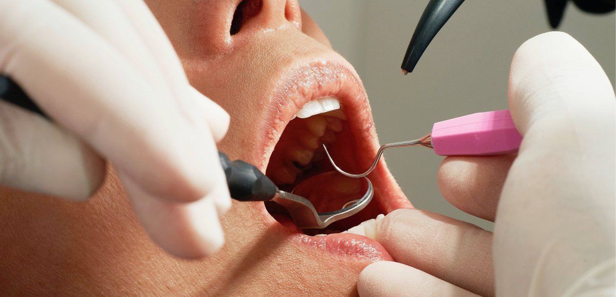 Dentiste suspendu à Cherbourg. La santé des patients en danger : que doivent-ils faire ?
