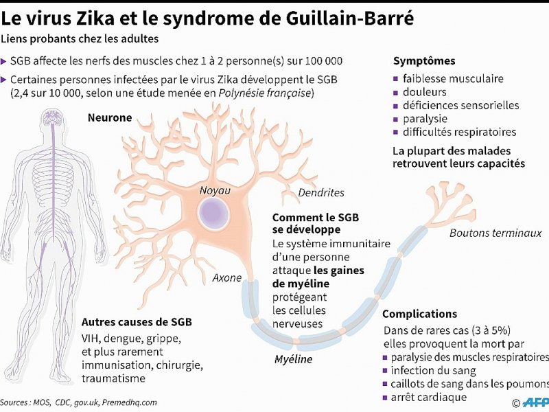 Le virus Zika et le syndrome de Guillain-Barré - John SAEKI, Laurence CHU [AFP]