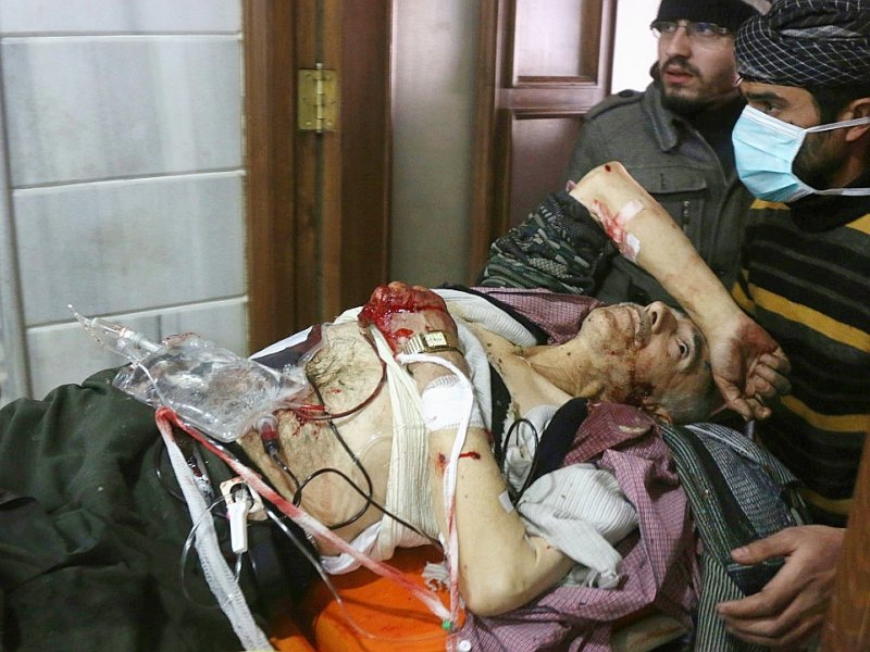 Un Syrien blessé reçoit des soins dans un hôpital de fortune dans le secteur Est d'Alep après avoir été victime d'un bombardement, le 18 novembre - THAER MOHAMMED [AFP/Archives]
