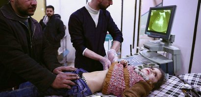 Une fillette est soignée dans un hôpital de fortune à Douma, dans la périphérie est de Damas, le 19 février 2017 - Abd Doumany [AFP/Archives]