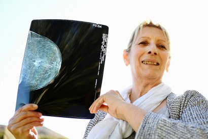 Une habitante de Fos-sur-Mer, souffrant d'un cancer montre le résultat de sa mammographie, le 10 mars 2017 - BORIS HORVAT [AFP]