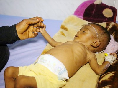 Un enfant yéménite reçoit des soins dans un hôpital de la ville de Hodeida, le 11 novembre 2017 - ABDO HYDER [AFP/Archives]