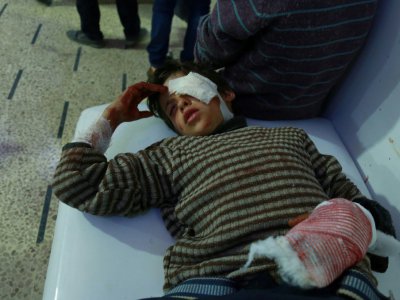 Un enfant syrien blessé hospitalisé dans la ville bombardée de Douma, le fief rebelle de la Ghouta orientale, aux portes de Damas, le 23 février 2018 - HAMZA AL-AJWEH [AFP]