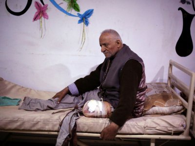 Un homme blessé dans une frappe aérienne reçoit des soins dans un hôpital de fortune dans la Ghouta orientale, une enclave rebelle près de Damas bombardée par le régime syrien le 25 février 2018 - AMER ALMOHIBANY [AFP]