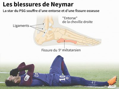 La star du PSG Neymar souffre d'une entorse à la cheville droite et d'une fissure sur un os du pied - Sophie RAMIS [AFP]