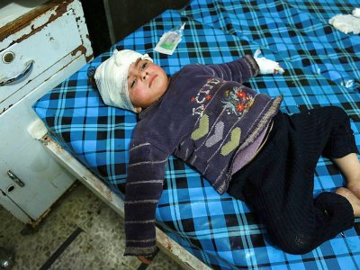 Un enfant syrien est soigné dans un hôpital de Douma, dans la Ghouta orientale, le 3 mars 2018 - HAMZA AL-AJWEH [AFP]