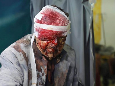 Un homme blessé attend dans une clinique de fortune de la ville de Zamalka, située dans une poche rebelle de la Ghouta orientale et visée par des bombardements du régime syrien, le 22 mars 2018 - Amer ALMOHIBANY [AFP]