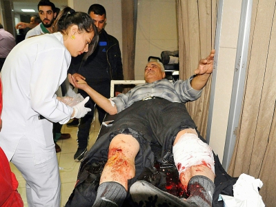 Photo fournie par l'agence de presse officielle syrienne Sana le 7 avril 2018 montrant un homme blessé recevant des soins dans un hôpital de la capitale syrienne Damas après des tirs de roquettes - STRINGER [SANA/AFP]