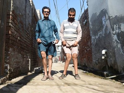 Basharat Ali et Naveed montrent leurs jambes déformées, à Kot Assadullah au Pakistan, le 25 février 2018 - ARIF ALI [AFP/Archives]