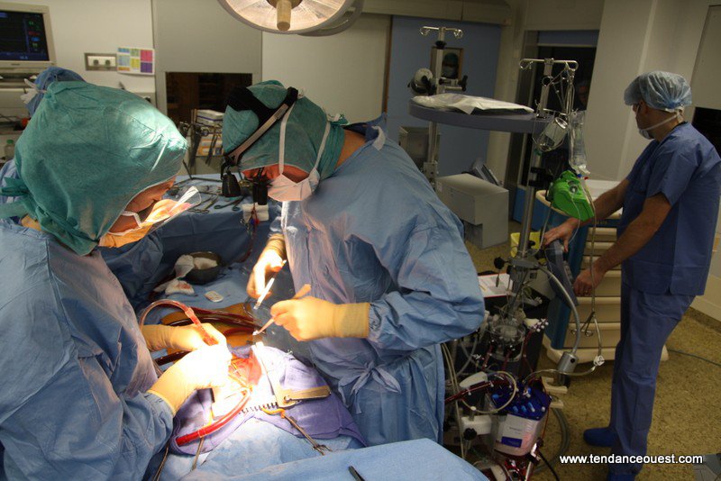 La chirurgie valvulaire - Chirurgie Cardiaque à Caen