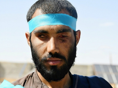 Zaheer Ahmad Zindani, dont les deux yeux ont été crevés lorsque le bus dans lequel il voyageait a sauté sur une mine, participe à une marche pour la paix, le 8 juin 2018 entre la province du Helmand et Kaboul - ZAKERIA HASHIMI [AFP]
