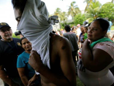Un homme montre les blessures reçues lors de son arrestation par la police, le 13 juin 2018 à Managua - INTI OCON [AFP]