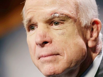 John McCain le 27 juillet 2017 à Washington. Le cancer a été découvert derrière un oeil - CHIP SOMODEVILLA [GETTY IMAGES NORTH AMERICA/AFP]