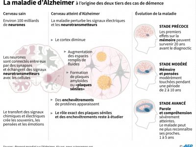 La maladie d'Alzheimer - Sabrina BLANCHARD [AFP]