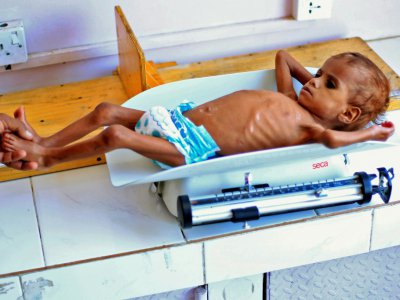 Un enfant yéménite souffrant de malnutrition est pesé dans un hôpital de la capitale yéménite Sanaa, le 6 octobre 2018 - MOHAMMED HUWAIS [AFP/Archives]