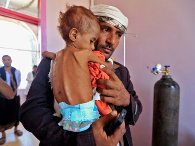 Un Yéménite portant dans ses bras son enfant souffrant de malnutrition. Photo prise le 6 octobre 2018 dans un hôpital de Sanaa - Mohammed HUWAIS [AFP]