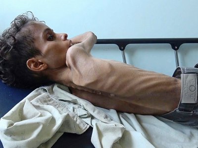Un enfant de 10 ans souffrant de famine le 19 novembre à Taez dans le pays en guerre. - marzooq AL-JABIRY [AFP]