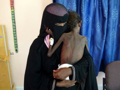 Une photo prise le 22 novembre 2018 montre une mère yéménite Nadia Nahari tenant son fils de cinq ans Abdelrahman, qui souffre de malnutrition sévère et pèse cinq kilos, dans une clinique dans la ville de Khokha, dans la province de Hodeida dans l'ou - - [AFP]