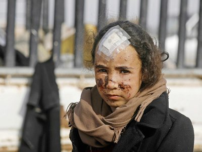 Une fillette blessée après avoir fui le dernier réduit du groupe jihadiste Etat islamique (EI), le 13 février 2019 dans la province orientale de Deir Ezzor - Delil souleiman [AFP]