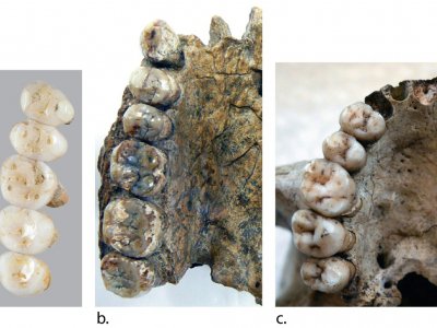 Comparaison entre des dentitions, sur l'île de Luçon le 15 mars 2019 - Florent DETROIT [Florent DETROIT/AFP/Archives]