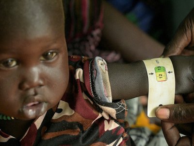 Un petit garçon soigné au centre de soins d'Udier, au Soudan du Sud, le 7 mars 2019 - SIMON MAINA [AFP]