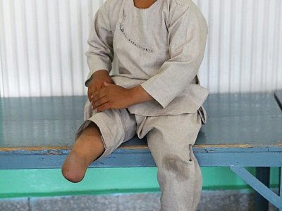 Ahmad Sayed Rahman a perdu sa jambe droite quand il a été atteint par des tirs entre belligérants, alors qu'il avait huit mois, ici à l'hôpital du comité international de la Croix Rouge, à Kaboul, le 7 mai 2019 - WAKIL KOHSAR [AFP]