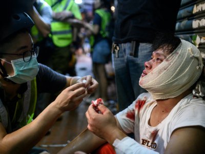 Un homme blessé à la suite de heurts avec les forces de l'ordre, le 5 août 2019 à Hong Kong - Philip FONG [AFP]