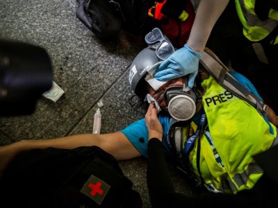 Un représentant de la presse reçoit les premiers soins après avoir été touché au visage par un projectile de la police, lors de heurts entre forces de l'ordre et manifestants, le 29 septembre 2019 à Hong Kong - ISAAC LAWRENCE [AFP]