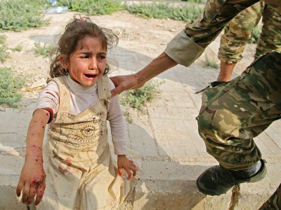 Une fillette syrienne blessée, le 20 octobre 2019 dans la ville de Tal Abyad, non loin de la frontière turque. - Bakr ALKASEM [AFP]