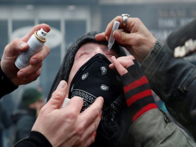 Du sérum physiologique contre les lacrymogènes, lors de la manifestation à Paris le 5 décembre 2019 - Zakaria ABDELKAFI [AFP]