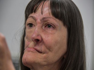 Denise Vicentin,défigurée après un cancer se regarde dans un miroir après une reconstruction à Sao Paulo, le 3 décembre 2019 - Nelson ALMEIDA [AFP]