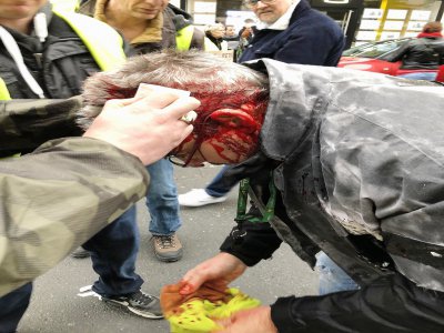 Au moins deux manifestants ont été touchés par les coups de matraque, ce jeudi 9 janvier, à Rouen. - DR