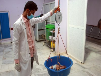 Un enfant souffrant de malnutrition est pesé dans un centre de santé de la province de Hajjah, dans le nord du Yémen en guerre, le 5 juillet 2020 - ESSA AHMED [AFP]