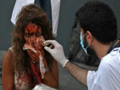 Un médecin soigne une femme devant un hôpital le 4 août 2020 après deux énormes explosions à Beyrouth - IBRAHIM  AMRO [AFP]