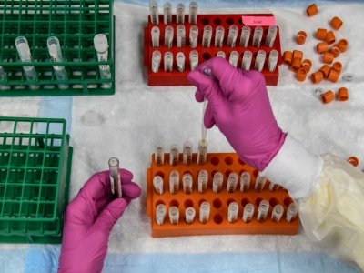 Un technicien de laboratoire manipule des échantillons sanguins dans le cadre du développement d'un vaccin contre le coronavirus, au Research Centers of America à Hollywood en Floride, le 13 août 2020 - CHANDAN KHANNA [AFP/Archives]