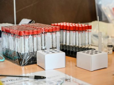 Des échantillons lors des tests au Covid-19 réalisés à Roubaix (Nord), le 11 janvier 2021, lors d'une campagne massive de tests - DENIS CHARLET [AFP]