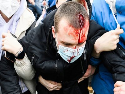 Un manifestant d'opposition blessé, le 23 janvier 2021 à Moscou - Kirill KUDRYAVTSEV [AFP]
