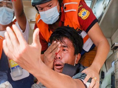 Photo prise le 20 février 2021 montrant un manifestant blessé à l'oeil à Mandalay, Birmanie - STR [AFP/Archives]