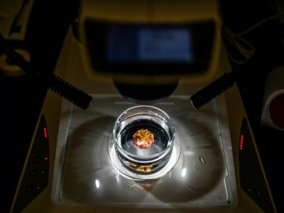 Observation au microscope de coraux dans un laboratoire de Miami, le 27 octobre 2021 en Floride - CHANDAN KHANNA [AFP]