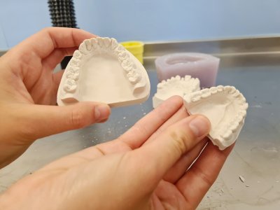 Les étudiants en odontologie apprennent à réaliser des prothèses dentaires à base de plâtre. Pour cela, ils utilisent des moules en silicone qui leur permettent d'obtenir la forme des dents. Puis vient ensuite la partie démoulage.